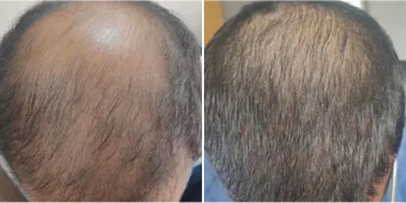 Before and After Transformation 1