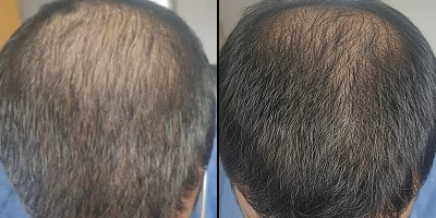 Before and After Transformation 2